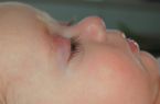 sick baby - My friend's baby is sick with pneumonia