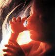 4-month fetus, alive as ever - Picture of a four month old fetus sucking its tiny little thumb