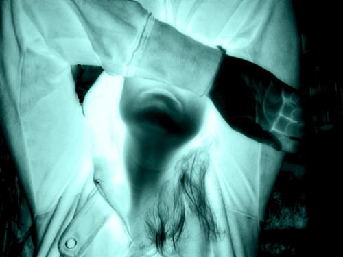 me - xray, me