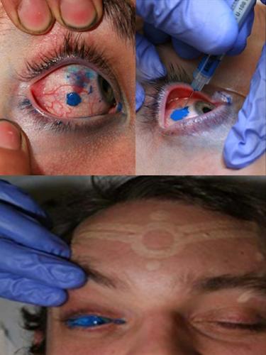 eye ball tattoo - I will not say anything about that and I don&#039;t have any comment on that, I just let you see the images, and you judge and you say what is that, for God sake.