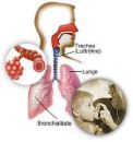 asthma - photo of the lungs