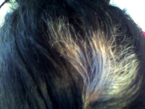 White hair. - One of my patches of white hair that are growing in.