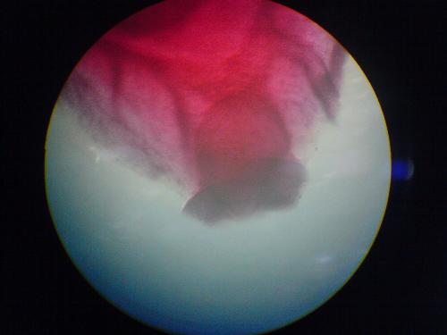 Fasciola hepatica - This is a picture of the oral sucker of Fasciola hepatica, a parasite. I took this during my Parasitology Laboratory class. :) Its common names are liver fluke or sheep liver fluke. It belongs to class Trematoda, phylum Platyhelminthes or the flat worms.