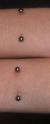 arm pocket piercing - So this is a pic of another pocket piercing, this on is on the forearms. its neat, but again...somthing i would NOT get done.