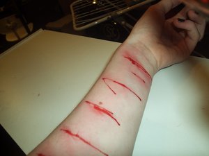 Cutting - Cuts on someones arm