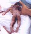aborted baby - this was a realy baby and it was really aborted . it lost its amr and its dead. why sumone wud do this is beyond me