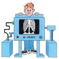 X-ray - AN exmpale of an x-ray machine used before the modern technology came.
