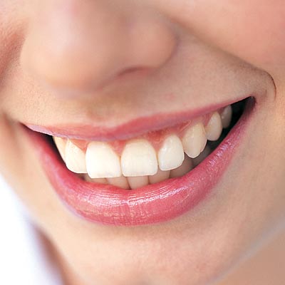 teeth - teen girl teeth smile.