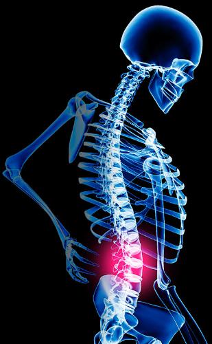 back pain - back painDM..