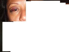 Response to this ! -  I don't think I essagerated when I said that my husband was mean and made my life miserable.