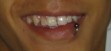 My Son's Lip Ring - It finally healed enough to make a decent photograph.