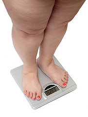 obesity - weight loss