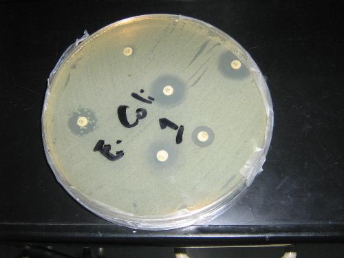 Culture and Sensitivity Testing - This is how they test whether a microorganism is resistant or susceptible to an antibiotic. The petri dish is where the bateria is streaked and grown and observed for their response.