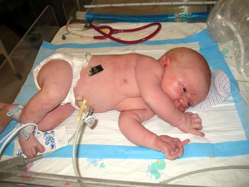 Birth - First Baby Photo