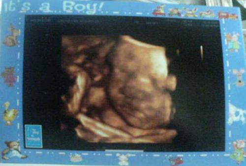 my baby - 3d4d ultrasound pic of my baby. taken two weeks ago.