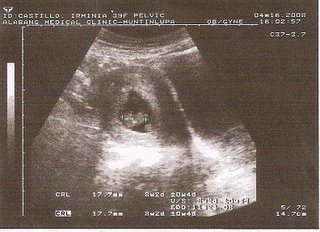 Ultrasound - New Baby