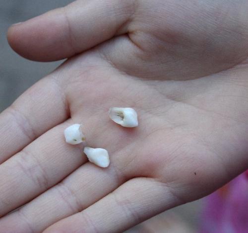 baby teeth - keeping your children's baby teeth. baby teeth - keeping your children's baby teeth.