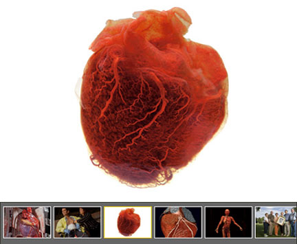 human heart - in high blood pressure there is an increase pressure or flow of blood from the heart.