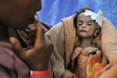 dying due to hunger - Enough food is produced globally to feed the planet but even so roughly 925 million people go to bed hungry every night. Hunger is a leading cause of death, killing an estimated 10 million people every year - more than AIDS, tuberculosis and malaria combined.
