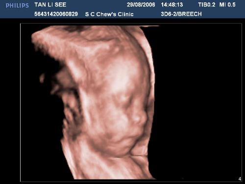 Baby before birth - This is a scan or picture of Baby Even before he was born. Modern technology has provided the means by which parents are able to view the foetus even before birth. What a wonderful sight to behold and prepare for its arrival.