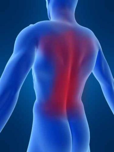 back Pain - Back pain in the lower back or low back is a common concern affecting up to 90% of people at somepoint in their lifetime up to 50% will have more than one episode.