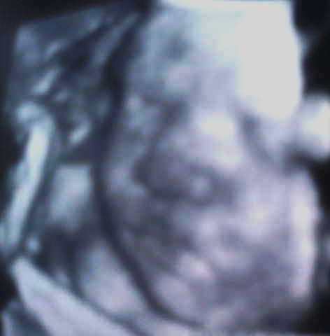 3d4d ultrasound - my during his 32nd week in my womb. 