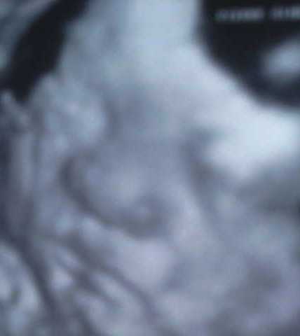 3d4d ultrasound - during my 33rd week of pregnancy.
