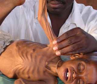 skin and bone child. - www.hizb.org.uk/hizb/images/stories/hunger.jpg 320 x 279 - 12k