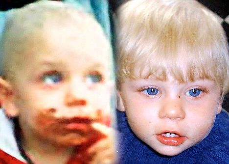 Baby P - Baby P, they smeared chocolate sauce on his face when people came to see him so they couldn't see the bruises on him!
