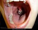 Weird Piercing - piercing