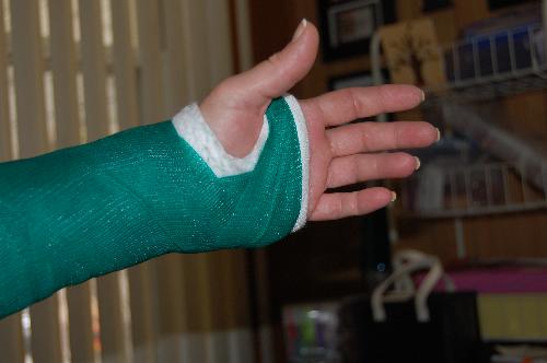 cast - it extends above my elbow, which is bent at 90 degree angle