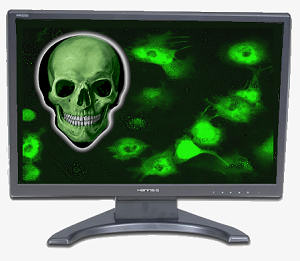 Virus on a computer - A photo showing a laptop that is infected with a computer virus or spyware.