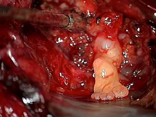 Foot Grows Inside The Brain Of A Newborn - Exactly what the subject line says lol...
