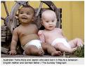 Twins - Twins born with different complexions, when one parent is black and the other is white.