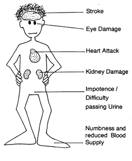 ill effects of diabetes - Diabetes on long run can affect multiple systems of your body. It can cause neuropathy,retinopathy,renal disorders if proper care & cautions are not taken care of. Wound healing is delayed & evenn it can result in gangrene of the extremities.