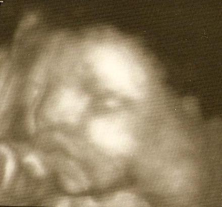 3d ultrasound of my angel - This was my inspiration before giving birth.