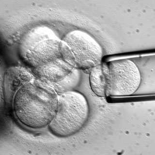 stem cells - manipulation of stem cells
