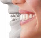 dental problem - dental checkup