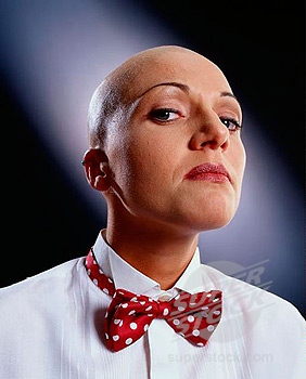 Bald Woman - Picture of a bald-headed woman