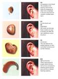 Hearing aids - I&#039;m getting two which is called bio cross because I&#039;m deaf in my left ear and about 70% loss on my right. The left aid will transfer to my right aid so I can hear from both sides. I won&#039;t be able to tell left from right but I&#039;ll be able to hear the sound regardless. People with hearing loss don&#039;t have a sense of direction at all and I&#039;m no exception. That&#039;s why when I came home from school, I&#039;d ask my mom where she was and if she&#039;d say "in here" I&#039;d ask "where&#039;s here?" because I couldn&#039;t tell which direction she called from.