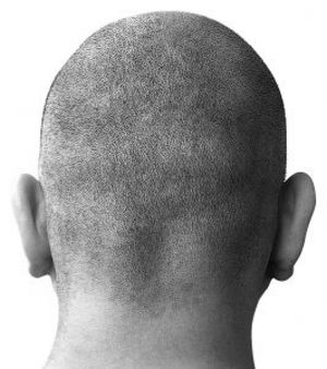 Man with bald head - Man with bald head in the black and white photo.
