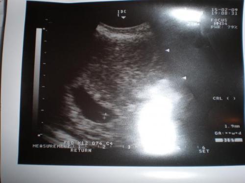 1st baby - its their first baby and my cousin and her wife are so excited to become parents.
