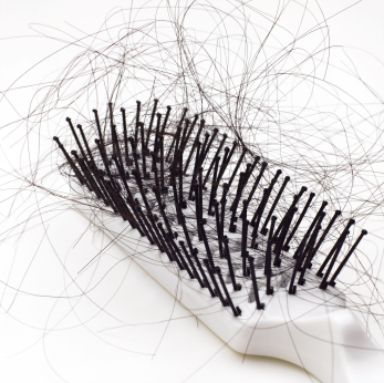 hair loss - brush with hair