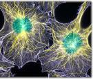 impulse to inspiration - microscopic photo of neuron impulse to inspiration - microscopic photo of neuron