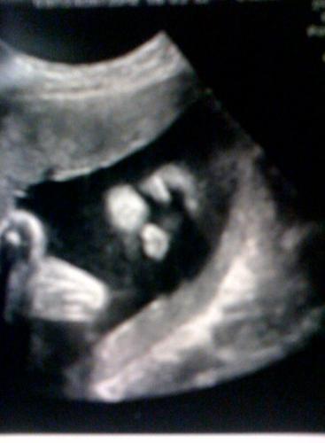my princess - sleeping in my womb....