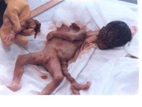 Abortion - Abortion is a very big crime. Please stop it.