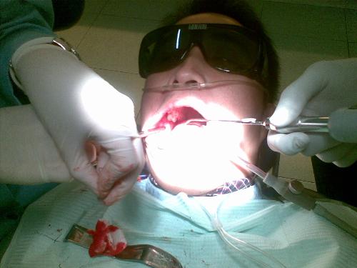 Surgery - This was done at Rosero's surgery room. One of my gruesome experiences in my life.