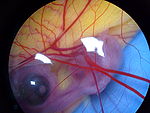 Chicken - One week old chicken embryo.