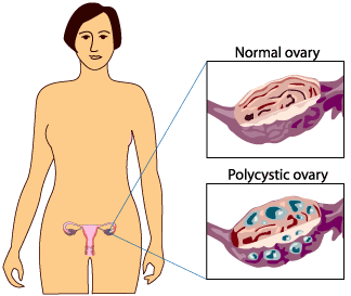 Body Picture - Anatomy of female body picture - reproductive glands
