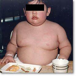 GoD!! Let stop it!! - Obese child!!